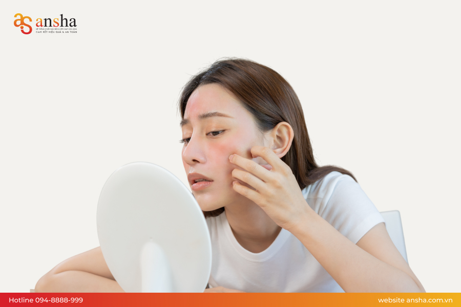 Tình trạng khô da khi giảm cân quá nhanh