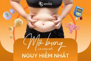 Mỡ bụng là loại mỡ nguy hiểm nhất