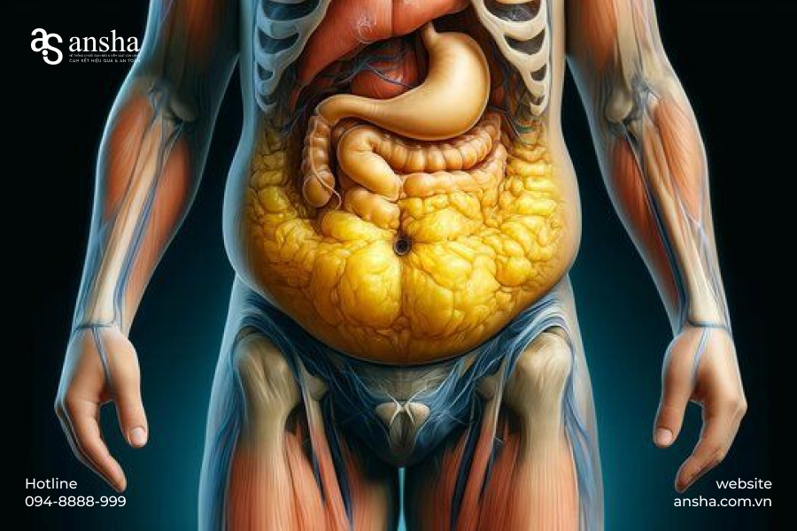 Dấu hiệu của rối loạn chuyển hóa - Vòng eo tăng