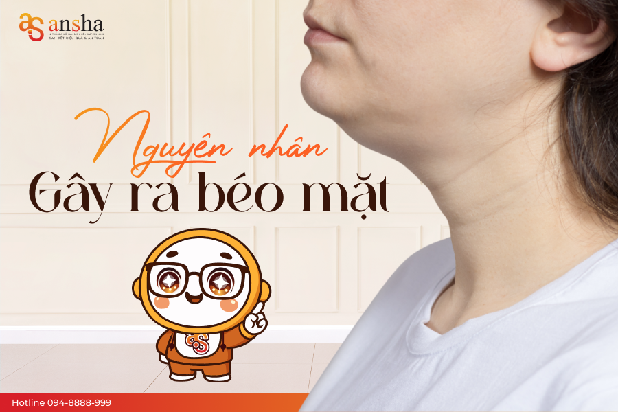 Nguyên nhân gây ra béo mặt